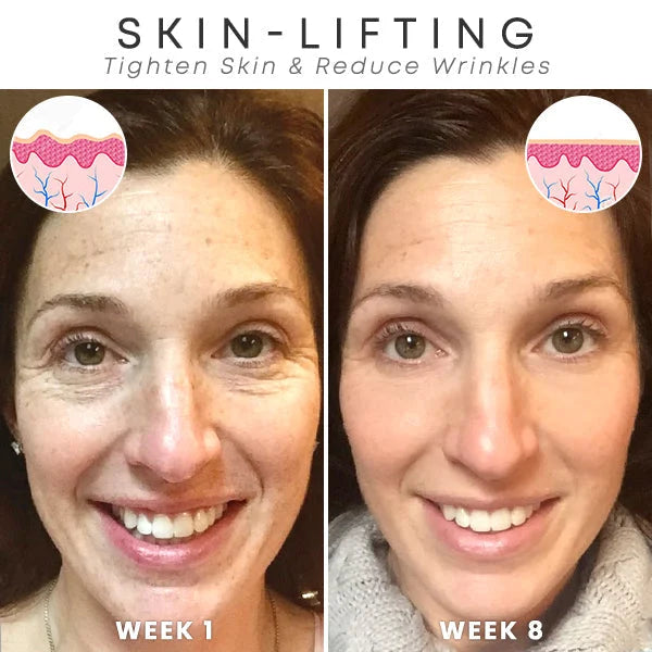 Last Day Promotion 70% OFFđ„Aging Serum