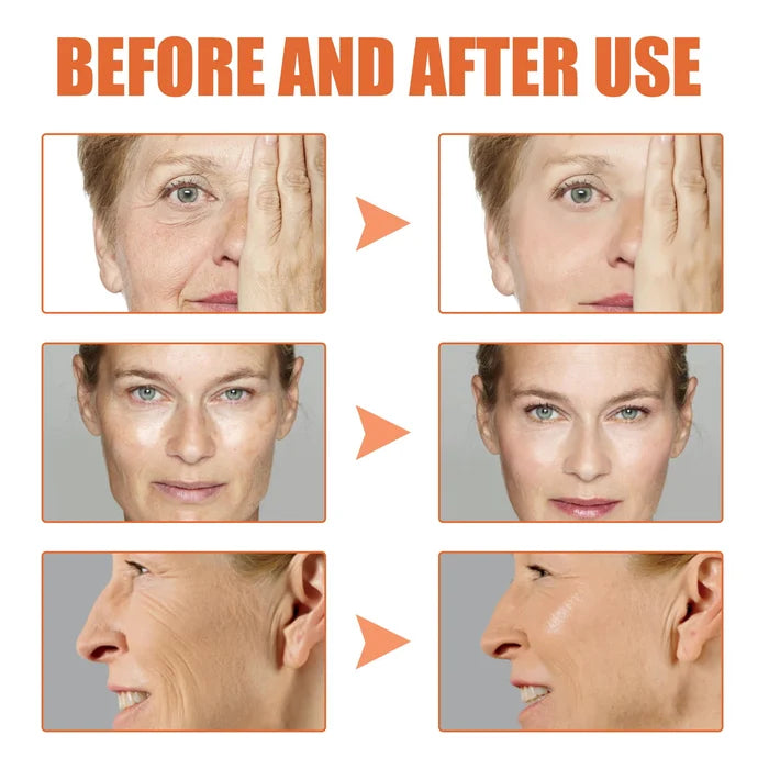 Last Day Promotion 70% OFFđ„Aging Serum