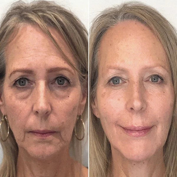 Last Day Promotion 70% OFFđ„Aging Serum