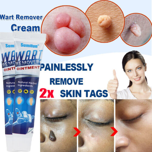 Wart Removal Ointment Plus【product fidelity!】