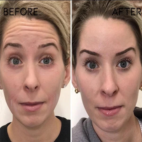 Last Day Promotion 70% OFFđ„Aging Serum