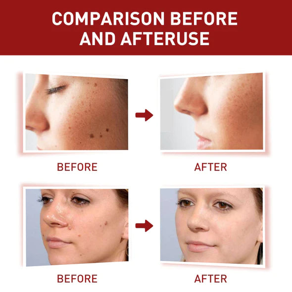 Organic Dark Spot Skin Serum(Limited Time Discount 🔥 Last Day)
