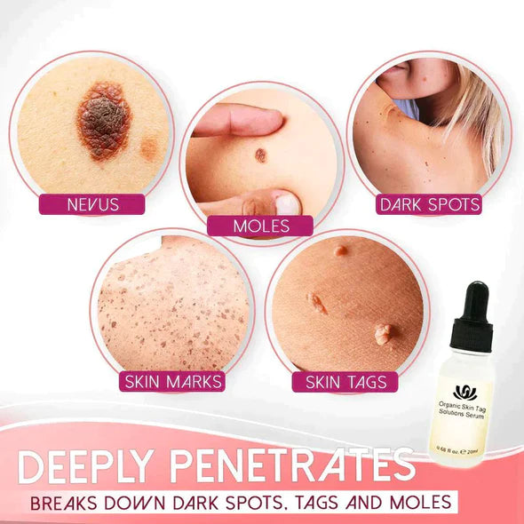 Organic Dark Spot Skin Serum(Limited Time Discount 🔥 Last Day)