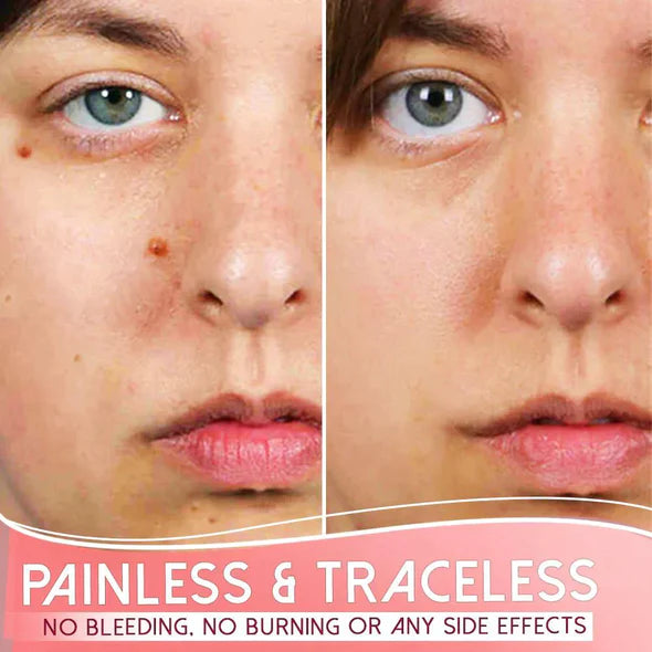 Organic Dark Spot Skin Serum(Limited Time Discount 🔥 Last Day)