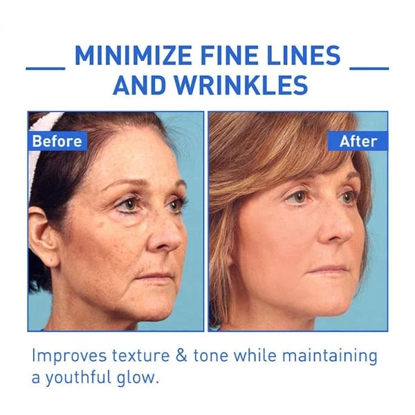 Last Day Promotion 70% OFFđ„Aging Serum