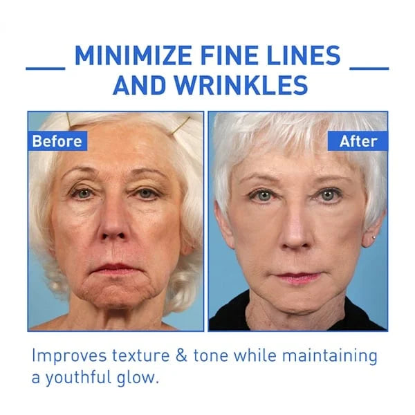 Last Day Promotion 70% OFFđ„Aging Serum