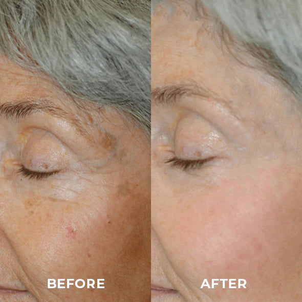 Organic Dark Spot Skin Serum(Limited Time Discount 🔥 Last Day)
