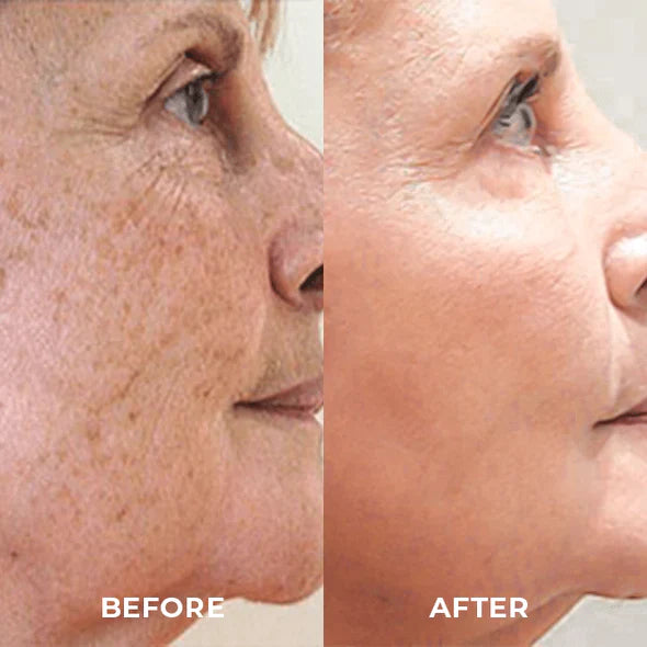 Organic Dark Spot Skin Serum(Limited Time Discount 🔥 Last Day)