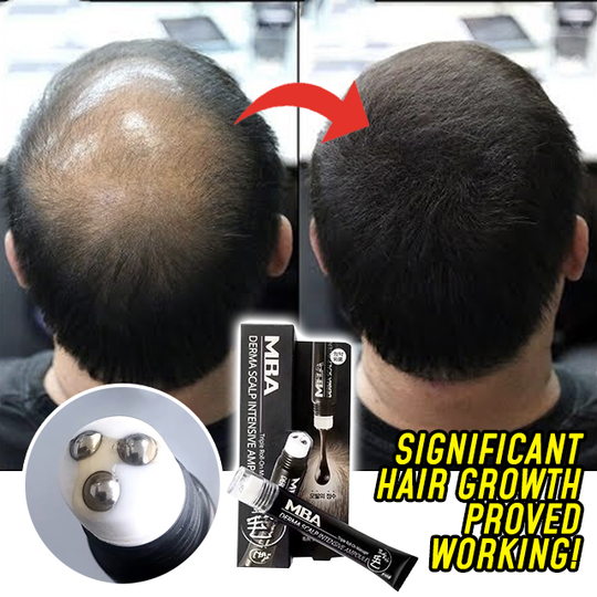 Scalp Intensive Ampoule Triple Roll-On Massager for Hair Loss, 20ml