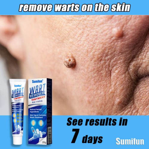 Wart Removal Ointment Plus【product fidelity！】