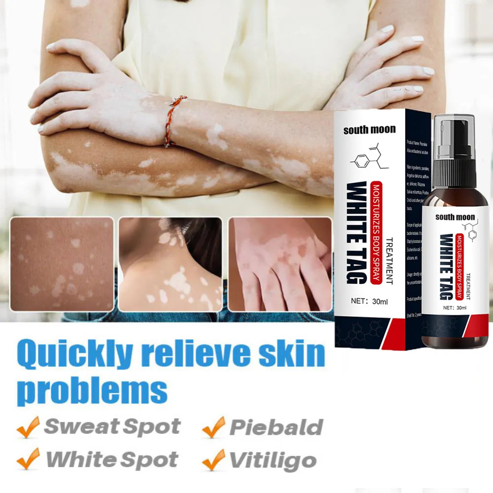 Vitiligo repair spray