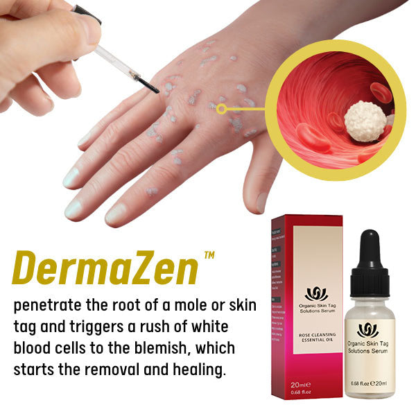 DermaZen™ Skin Tag Remover