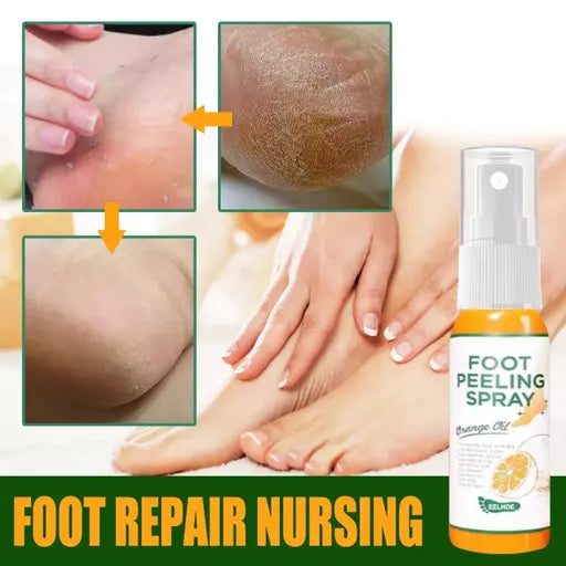 Oveallgo™ Foot Callus Removal Spray