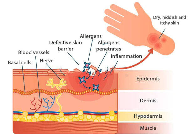 Dermax™ Folliculitis Clearing Spray