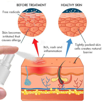 Dermax™ Folliculitis Clearing Spray