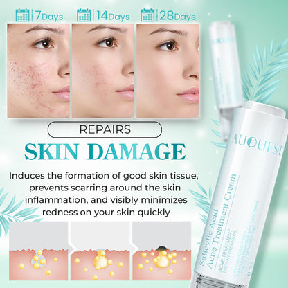 AUQUEST Salicylic Acid Acne Treatment Cream