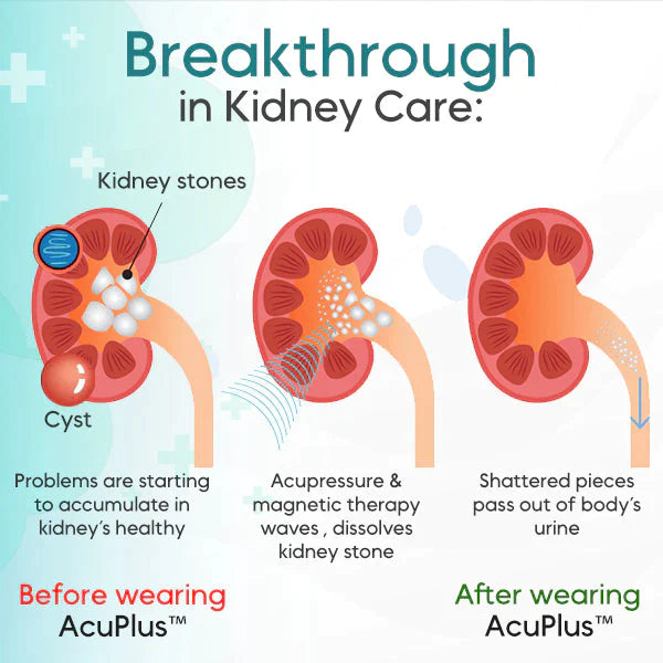 🔥 Last Day 50% OFF - Kidney Care Point Clip