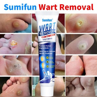 Wart Removal Ointment【3 Day Delivery&Cash on delivery】