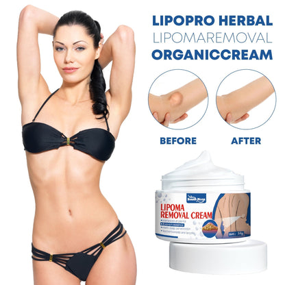 LipoPro Herbal LipomaRemoval OrganicCream