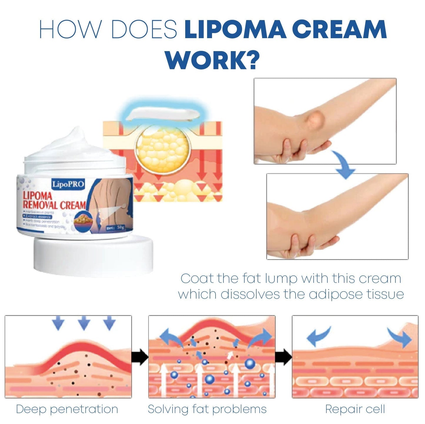 LipoPro Herbal LipomaRemoval OrganicCream