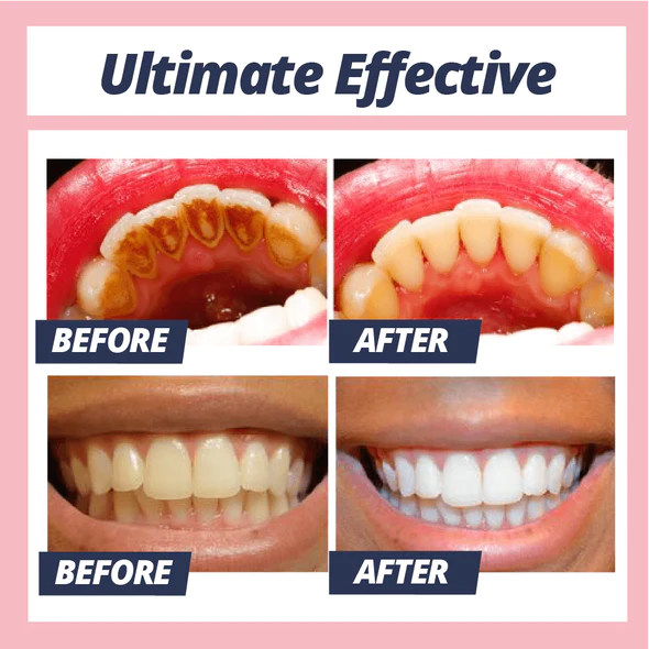 Stain Removal Whitening Toothpaste