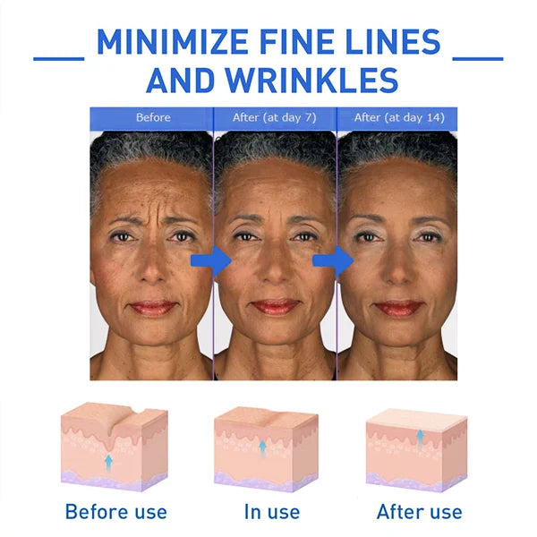 🔥Last Day Promotion 50% OFF - 🔥Deep Anti-Wrinkle Essence