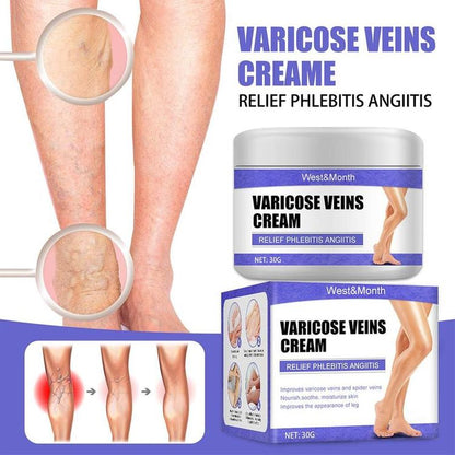 Varicose Veins Treatment Cream