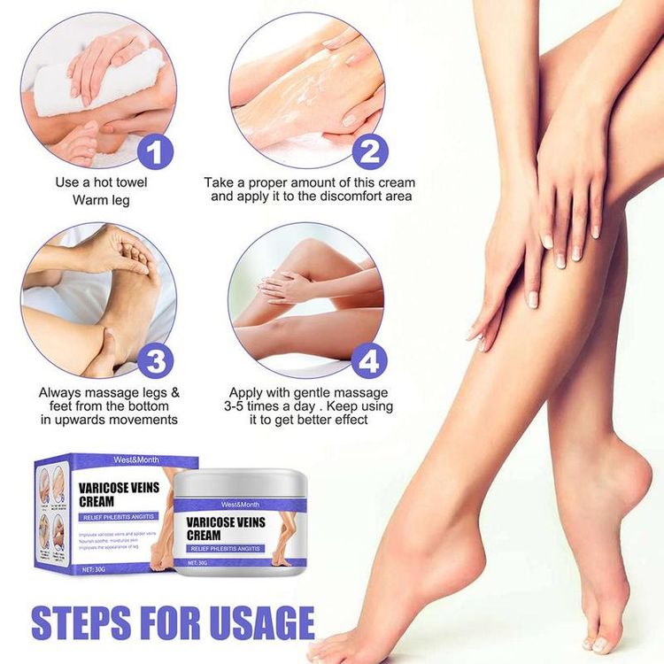 Varicose Veins Treatment Cream