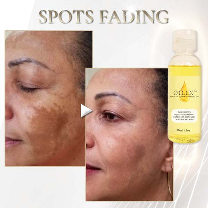 Oilex™ Natural Spots Whitening Yellow Peeling Oil